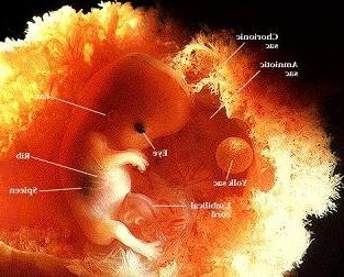 зародыш на 3м месяце беременности