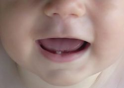 температура на зубы у ребенка