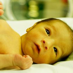 желтуха у новорожденных причины лечение