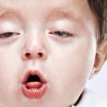 Прислушайтесь, нет ли у ребенка хрипов или свиста, сопровождающих дыхание в спокойном состоянии и во время приступа.