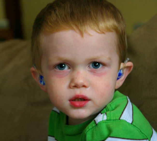 Красные шелушащиеся пятна вокруг глаз у ребенка