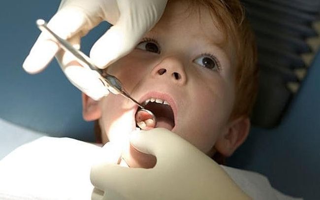 Почернел молочный зуб у ребенка после лечения пульпита